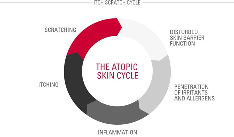 The Atopic Skin Cycle (also known as the Itch-Scratch Cycle)